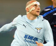 Rocchi con maschera naso rotto